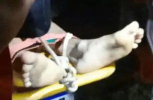 Adolescente é atingido por pedra após cair de cachoeira em cidade no Piauí (Foto: Reprodução/Cidadesnanet)