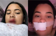 Influencer piauiense tem boca mordida pelo próprio cachorro de estimação