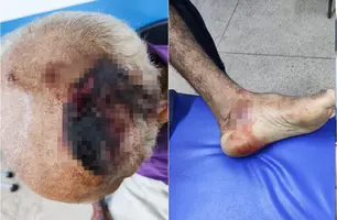 Família é agredida (Foto: Foto: Polícia Militar do Piauí)