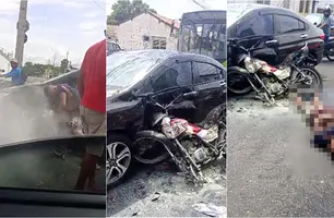Homem fica com corpo queimado após colidir moto em veículo em Teresina (Foto: Reprodução)