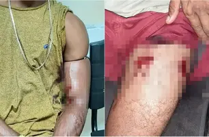 Jovens são baleados enquanto conversavam na calçada em José de Freitas (Foto: Reprodução)