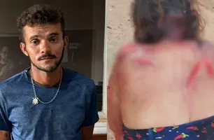 Polícia prende homem que tentou matar mãe a facadas por sumiço de gato (Foto: Reprodução)