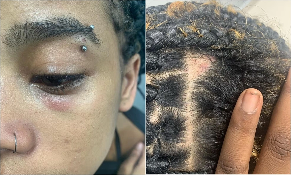 Rapper foi agredida em metrô na noite deste domingo (10)