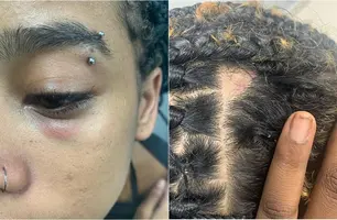 Rapper foi agredida em metrô na noite deste domingo (10) (Foto: Reprodução)