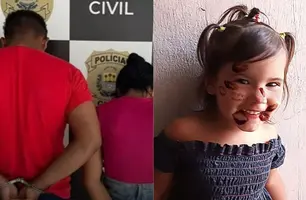 Delegado detalha prisão de pais suspeitos de matar criança espancada em Esperantina (Foto: Reprodução/Arquivo Pessoal)