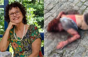 Escritora Roseana Murray é atacada por três pitbulls e tem braço dilacerado (Foto: Reprodução)