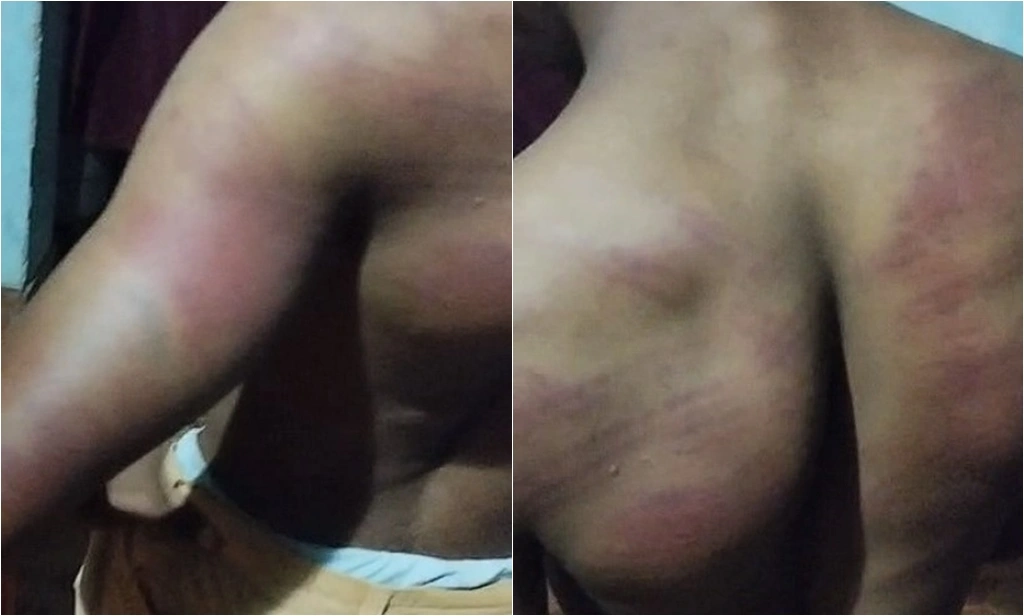 Jovem quilombola é espancado por policiais militares