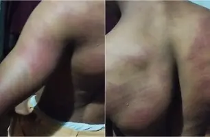 Jovem quilombola é espancado por policiais militares (Foto: Reprodução)