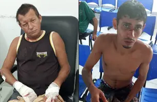 Amigos se esfaqueiam durante bebedeira e acabam em hospital em Cocal (Foto: Reprodução)