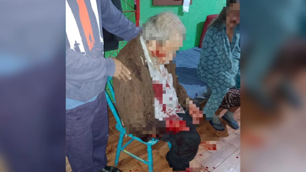 Criminosos invadem casa e espancam casal de idosos para roubar botijão de gás