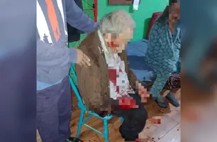 Criminosos invadem casa e espancam casal de idosos para roubar botijão de gás (Foto: Divulgação)