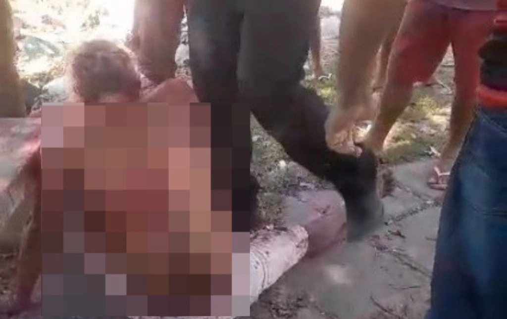 Homem é agredido com golpes de faca pelo próprio irmão na zona Norte de Teresina