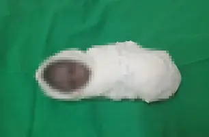 Polícia investiga funcionária que abortou dentro de hospital em Demerval Lobão (Foto: Reprodução)