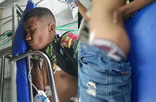 Criminoso tenta assaltar casa em Teresina e é baleado nas nádegas (Foto: Reprodução)