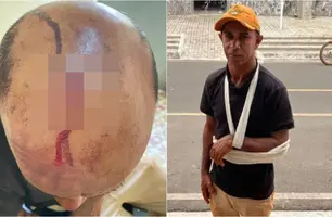 Homem é baleado e atingido por pedrada no Piauí (Foto: Portal Longah)