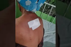 Mãe foi esfaqueada pelo filho (Foto: Reprodução)