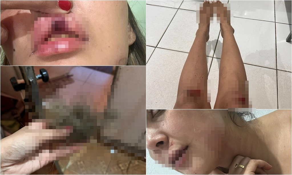 Mulher é brutalmente agredida pelo ex-namorado em via pública em Pedro II
