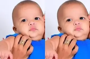 Bebê de um ano morre após ser atropelado por uma van em Imperatriz (Foto: Reprodução)