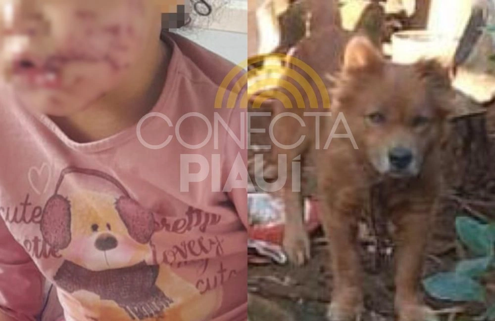 Cachorro invade quintal de residência e ataca criança em Santa Catarina