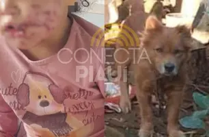 Cachorro invade quintal de residência e ataca criança em Santa Catarina (Foto: Reprodução)