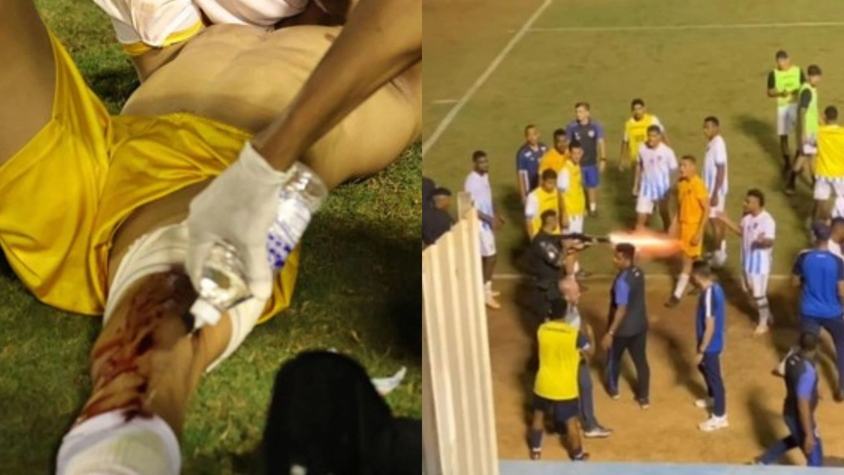 Goleiro é atingido por bala de borracha durante confusão no Campeonato Goiano