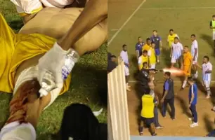 Goleiro é atingido por bala de borracha durante confusão no Campeonato Goiano (Foto: Grêmio Anápolis)