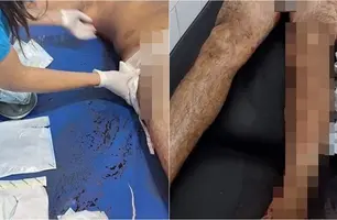 Irmãos são baleados em Regeneração (Foto: Reprodução)