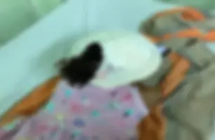 Menina de quatro anos é atacada por cão da raça pit monster em Oeiras (Foto: Divulgação)