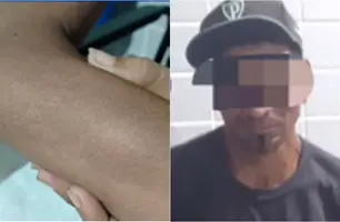Mulher é agredida com cabo de enxada pelo próprio companheiro em Campo Maior (Foto: Reprodução/IG Notícias de Campo Maior)