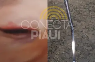 Mulher é espancada com cabo de vassoura pelo ex-namorado em Teresina (Foto: Repórter 12/Conecta Piauí)