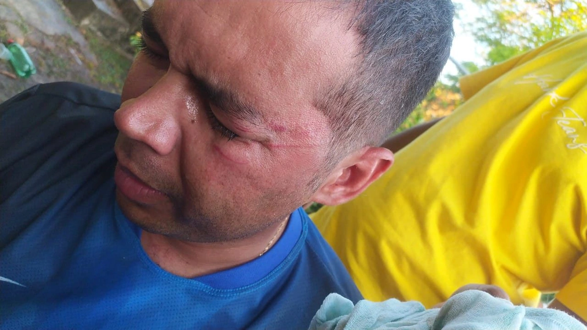 Professor é agredido por engenheiro em evento na zona rural de Demerval Lobão
