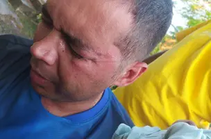 Professor é agredido por engenheiro em evento na zona rural de Demerval Lobão (Foto: Reprodução)
