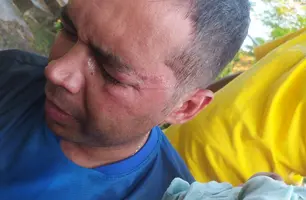 Professor é agredido por engenheiro em evento na zona rural de Demerval Lobão (Foto: Reprodução)