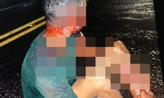 Homem fica gravemente ferido após ser atacado por vários cachorros no Piauí