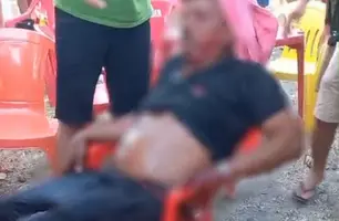 Segurança de festa é esfaqueado durante confusão em cidade do Piauí (Foto: Reprodução)