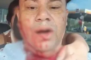 Empresário sofre tentativa de homicídio dentro de casa no Rio Grande do Norte (Foto: Reprodução)