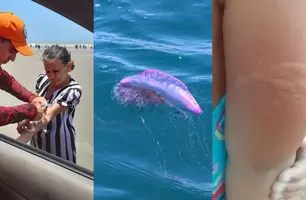 Luís Correia: caravelas-portuguesas causam queimaduras em mais de 40 banhistas (Foto: Reprodução)