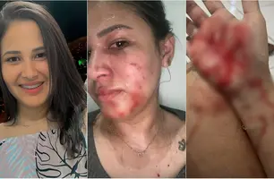 Blogueira é atacada com golpes de tesoura na frente de filha em município no Piauí (Foto: Reprodução)