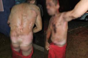 Mulher é presa em flagrante após incendiar companheiro em Elesbão Veloso (Foto: Reprodução)