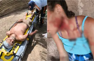 Pai atira contra filha e depois em si mesmo em município no Piauí (Foto: Reprodução)