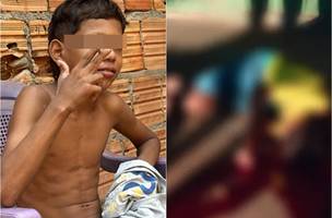 Adolescente de 13 anos com mais de 20 passagens na polícia é morto a tiros no Pará (Foto: Reprodução) Adolescente de 13 anos com mais de 20 passagens na polícia é morto a tiros no Pará (Foto: Reprodução)