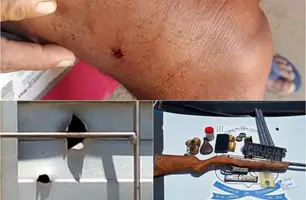 Cadeirante atira no próprio pai após briga e é preso; alegou sofrer maus-tratos (Foto: Reprodução)