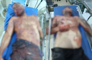 Confronto entre policiais e criminosos deixa dois mortos na zona rural de Timon (Foto: Reprodução) Confronto entre policiais e criminosos deixa dois mortos na zona rural de Timon (Foto: Reprodução)