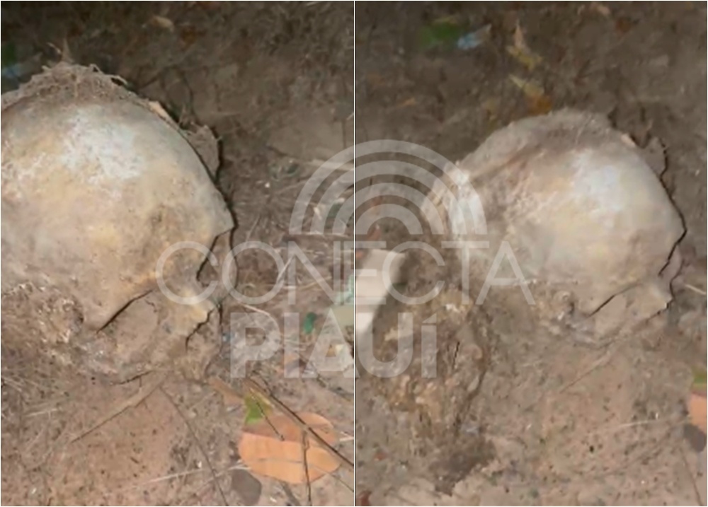 Crânio humano com cabelo é encontrado no interior de Demerval Lobão