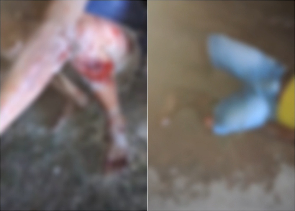 Duas pessoas ficam gravemente feridas em acidente causado por falta de sinalização em Aldeias Altas