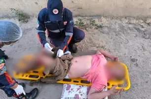 Homem é baleado na zona rural de Parnaíba e levado em estado grave ao HEDA (Foto: Reprodução)