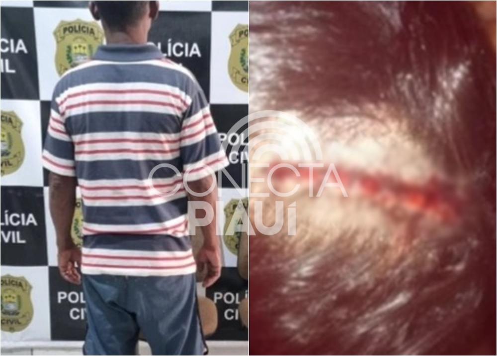 Homem é preso em Oeiras após espancar companheira por ciúmes em cidade do Piauí