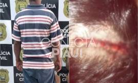 Homem é preso em Oeiras após espancar companheira por ciúmes em cidade do Piauí (Foto: Reprodução)