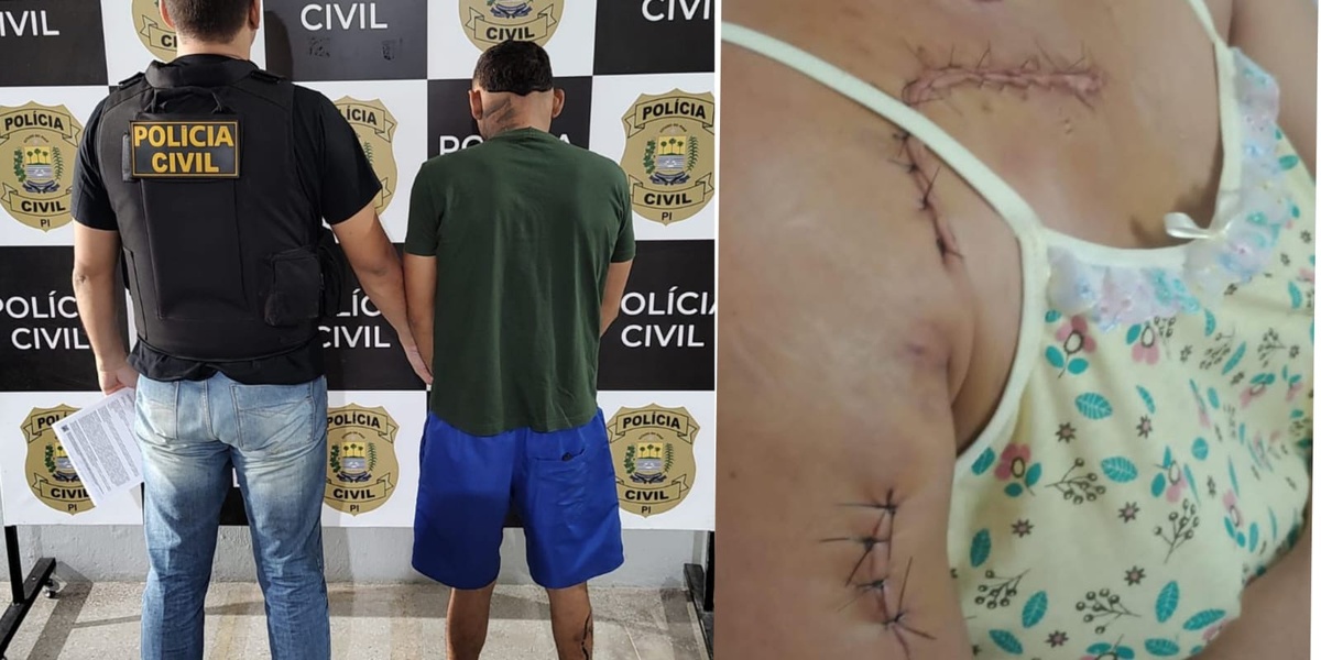 Homem que esfaqueou ex-companheira é preso pela Polícia Civil em Campo Maior