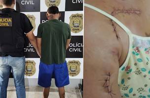 Homem que esfaqueou ex-companheira é preso pela Polícia Civil em Campo Maior (Foto: Reprodução)